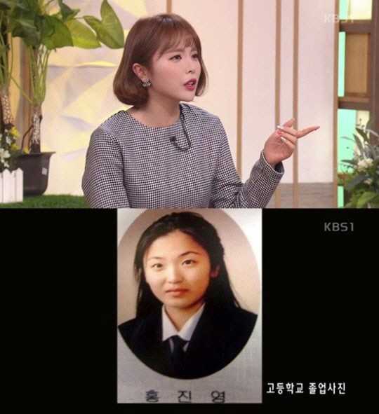 í™ì§„ì˜ ì„±í˜•ì „ ì‚¬ì§„ ë³´ë‹ˆ í‰ë©´ì ì¸ ì–¼êµ´ì„ ê³ ì¹˜ë ¤ ì„±í˜•í•œ ê²ƒ ì´ìŠˆ ì—°ì˜ˆ ê¸°ì‚¬ë³¸ë¬¸ êµ­ì œë‰´ìŠ¤