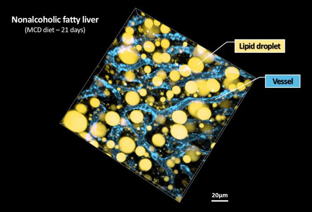 지방간의 3차원 생체현미경 영상 결과.