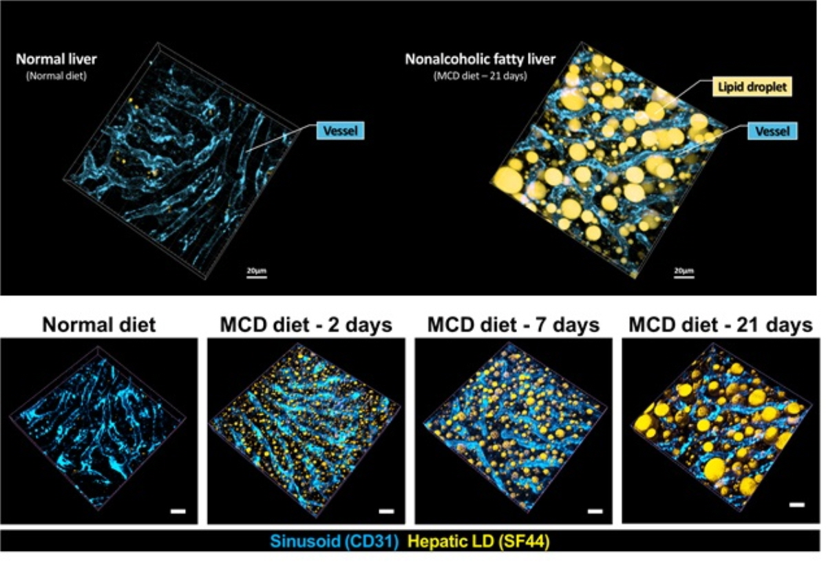 비알콜성지방간(Nonalcoholic fatty liver)단계에서 지방구(Lipid droplet, 황색)축적을 보여주는 3차원 생체현미경 영상 결과