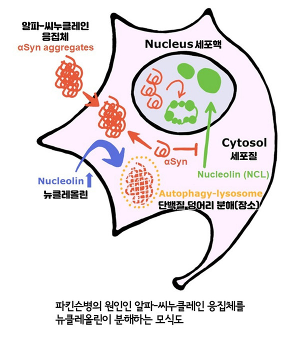 (사진=원광대학교) 파킨슨병 원인인