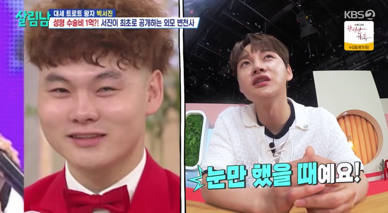 가수 박서진, 성형 변천사 공개