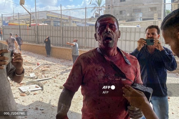 2025년 8월 25일 가자지구 남부 칸유니스에 있는 나세르 병원에 대한 이스라엘의 공습으로 부상을 입은 팔레스타인 사진기자 하템 오마르. 사진제공/AFP통신