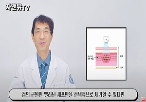 [얼굴점,모반]맞춤 레이저 시술로 흉터/자국없이 깨끗하게 제거해줍니다. 10