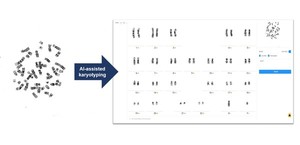 GC녹십자의료재단, 대한진단유전학회 학술대회 참가 - 뉴스 썸네일 이미지