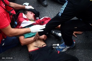 <b>시위</b> 취재 중 다친 <b>아르헨티나</b> 사진기자
