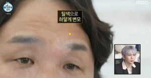 <b>구성환</b>, <b>백반증</b>으로 받았던 <b>고통</b>...'이것' 했으면 속내
