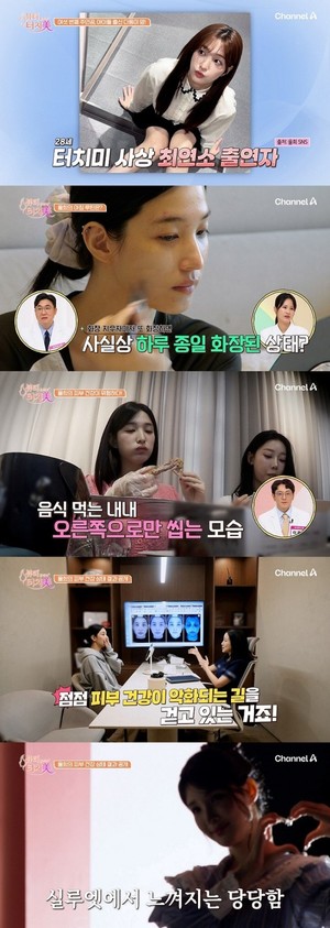 '터치미' <b>율희</b>, 아이 셋 육아로 무너진 <b>피부</b> 건강...맞춤 솔루션 공개